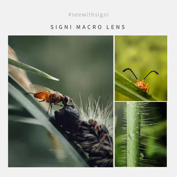 Hidden Tricks of External Smartphone Lenses: Macro Lenses for Skin Microbiome Photography and Wide-Angle Lenses for Cat Eye Surveillance